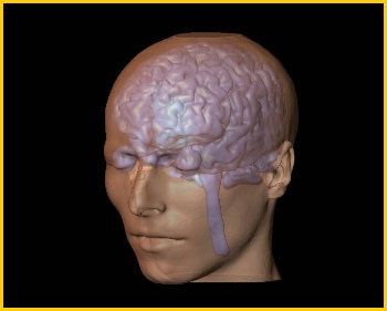 bipolar